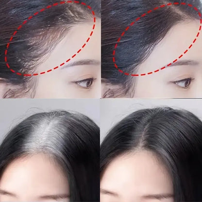 Two Colors of Hairline Concealer Powder, Hairline Shadow Powder, Natural Coverage, Waterproof and Sweat-Proof, Unisex, Suitable for People with Sparse Hair